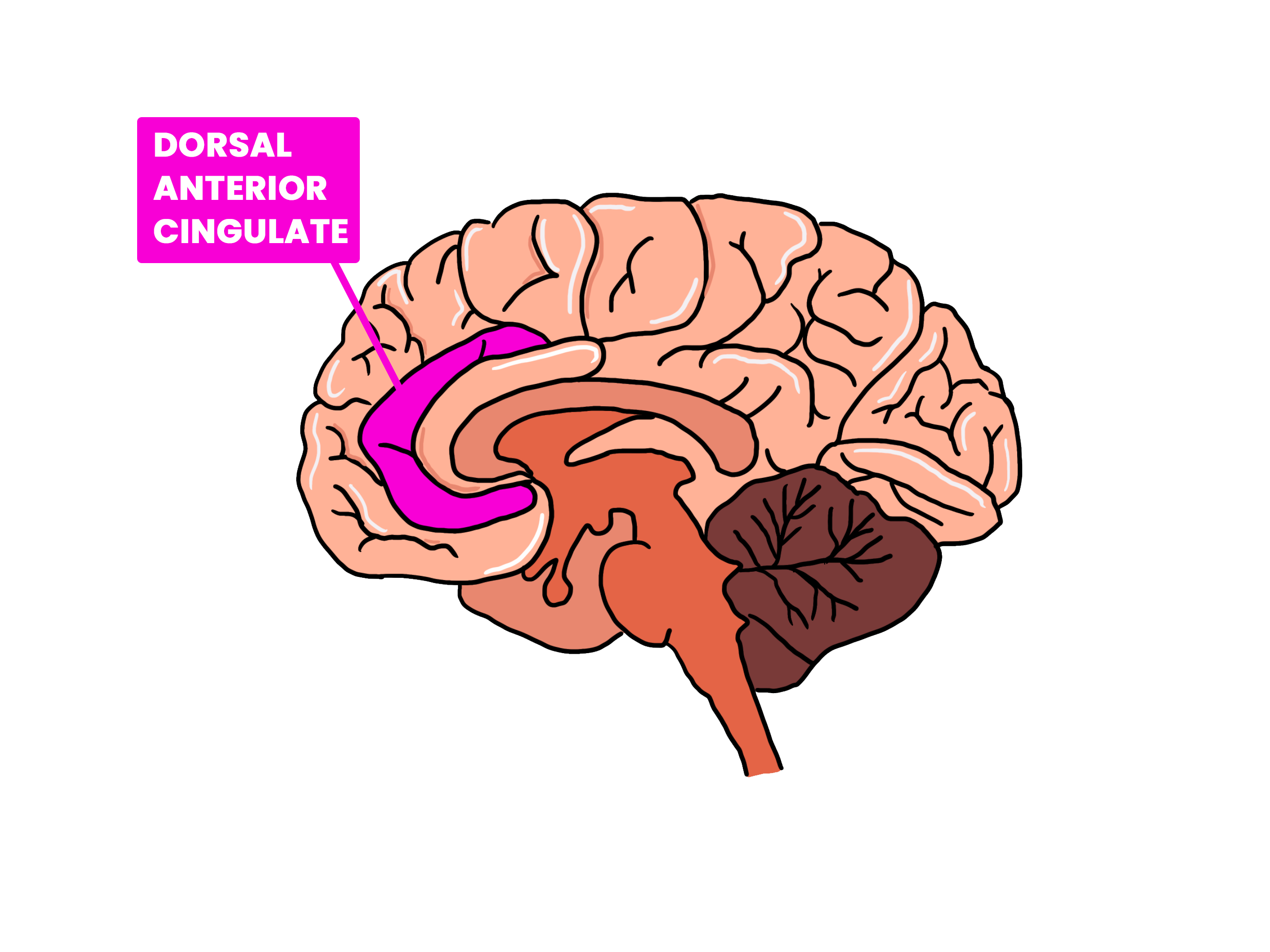diagram showing how hypnosis & self-hypnosis affects the brain region of the Dorsal-anterior-cingulate